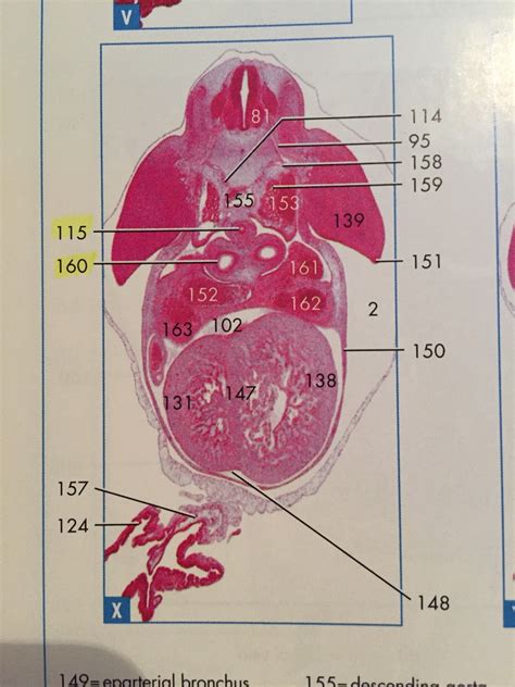 12.15 pig embryo 10mm X Diagram | Quizlet