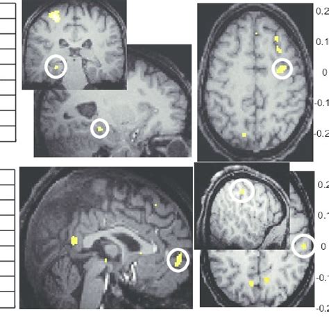 Main Effects Of Slow And Fast Sleep Spindles A E Left Fmri Responses