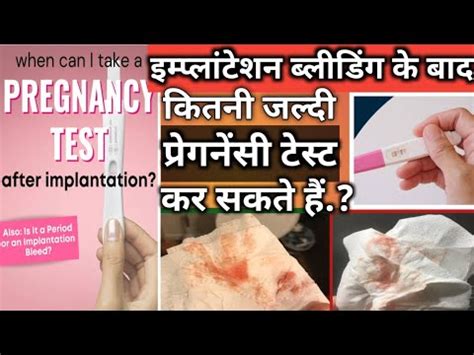 Implantation Bleeding Ke Baad Pregnancy Test Kab Kare Pregnancy Test