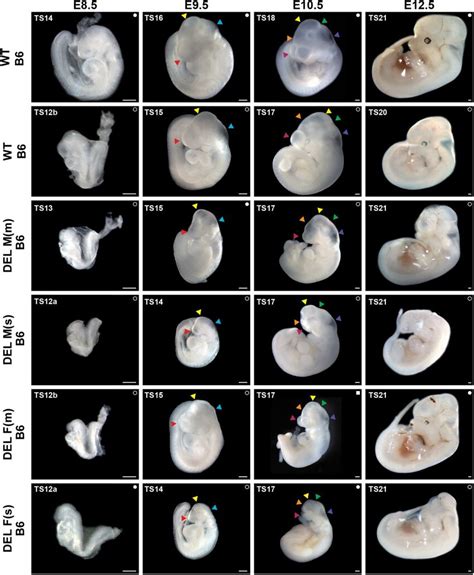 Anterior Malformations Of B Q Del Embryos Representative Male And