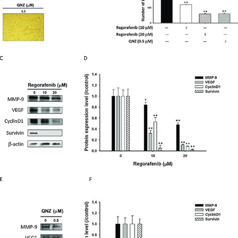 Cytotoxicity And Aktnf κb Inhibition Effect Of Regorafenib Treatment