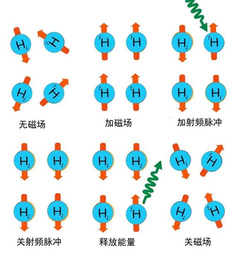 《医用物理》磁共振成像mri的简单原理 中国核技术网