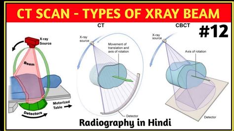 Type Of X Ray Beam Youtube