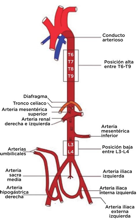 Colocación y posicionamiento de catéteres umbilicales