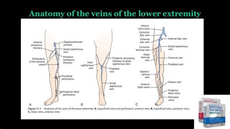 Update venous reflux