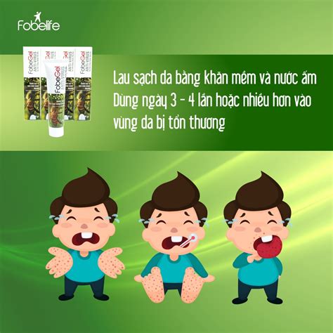 Gel Tái Tạo Da Anti Virus Fobe Gel Fobelife