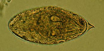 Schistosoma Japonicum