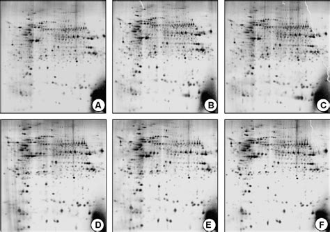 Figure 1 From Proteomic Differentiation Pattern In The U937 Cell Line