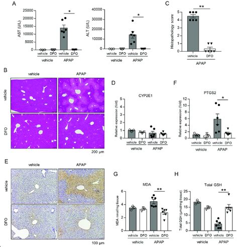 Iron Chelator Inhibits Apap Induced Hepatotoxicity And Lipid