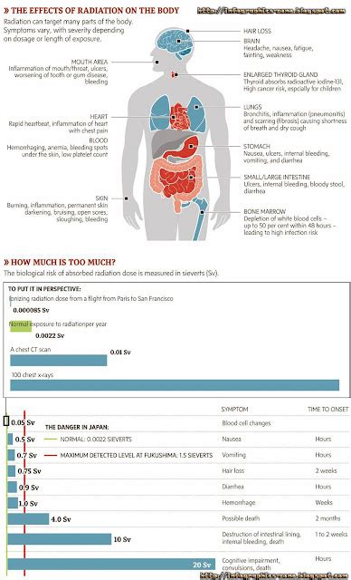 Infographics Zone Radiation Exposure Info