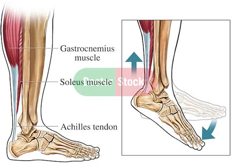 Achilles Tendon Lateral Side View Doctor Stock