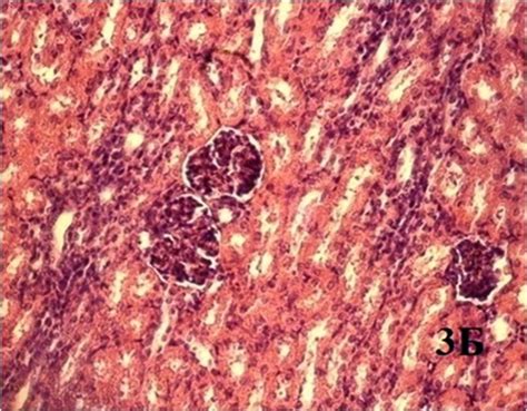 B Cortical Substance Of A Pig Kidney With Granular Dystrophy Signs And