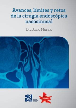 Avances Limites Y Retos De La Cirugia Endoscopica Nasosinusal Peq PDF