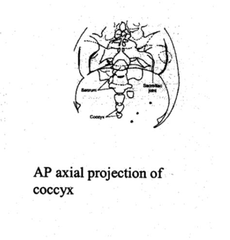 L Spine Sacrum Coccyx And Si Joints Study Guide 2023 Flashcards