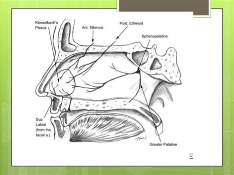 Septal perforation