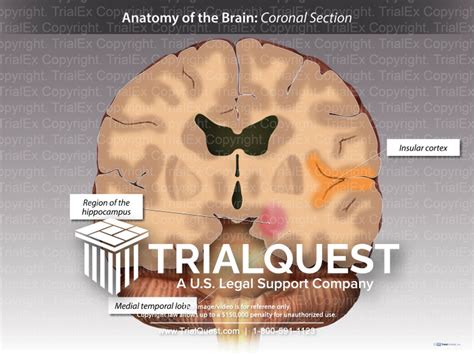 Anatomy of the Brain: Coronal Section - TrialExhibits Inc.