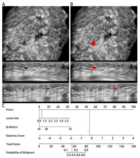 Diagnostics Free Full Text Automated Breast Volume Scanner Abvs