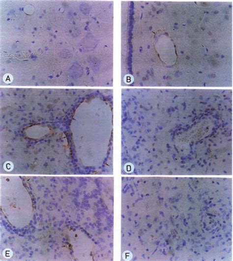 Photomicrograph Of Wax Embedded Cns Sections From A Normal Lewis Rat