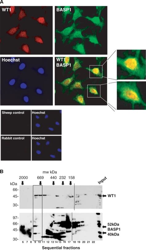 Wt And Basp Localization In Mpc Podocyte Precursor Cells A Mpc