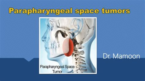 parapharyngeal space tumors