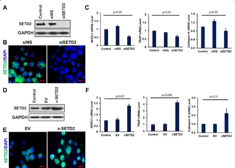 Setd Induced Osteoclast Markers Expression Levels Of Setd Was