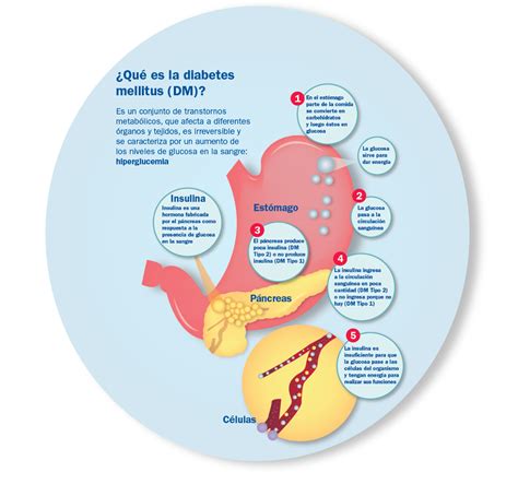 Diabetes Mellitus Diferencias De La Diabetes Mellitus Tipo 1 Y 2 97a