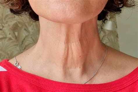 Dra Sandra Narea Especialista En Armonizaci N Orofacial Avanzada