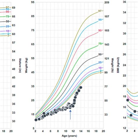 Growth charts. The patient's height, weight and body mass index (BMI ...