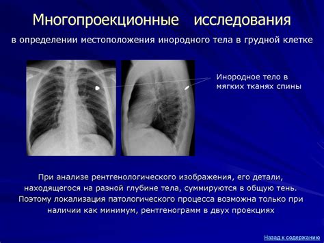Рентгенология. История развития рентгенологии - презентация онлайн