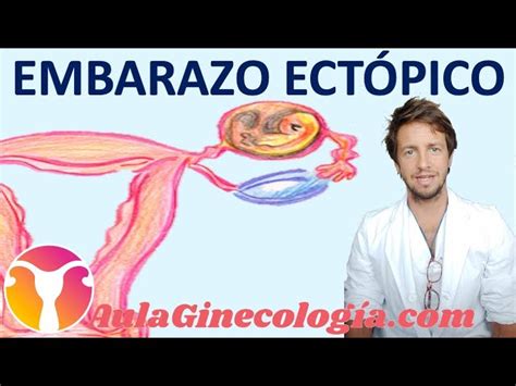 Identifica las Diferencias Aborto vs Embarazo Ectópico Guía