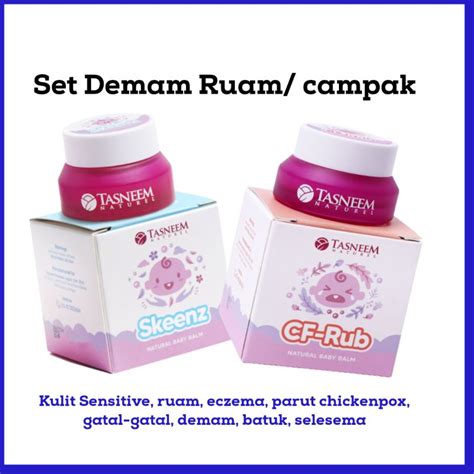 Tasneem Naturel Set Demam Ruam Chickenpox Skeenz Cf Rub Demam Baby