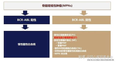 专家讲座 张磊教授带您了解原发性血小板增多症的诊断与治疗（上） 知乎