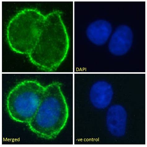 Recombinant Anti MUC1 Antibody SM3 Ab245695 Abcam