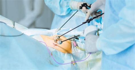 Laparoscopic Surgery Purpose Procedure And Benefits