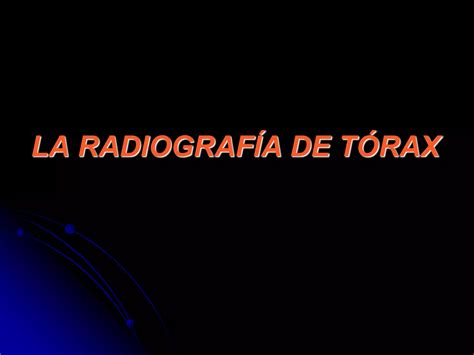 Interpretaci N Radiograf A T Rax Oit Neumoconiosis Dr Casanova Ppt