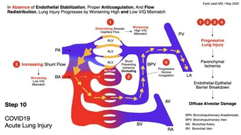 Covid Acute Lung Injury Step Rebel Em Emergency Medicine Blog