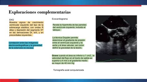 Estenosis E Insuficiencia Aortica Pptx