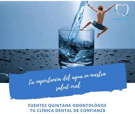 La Importancia Del Agua En Nuestra Salud Oral Tuimplantedental Es