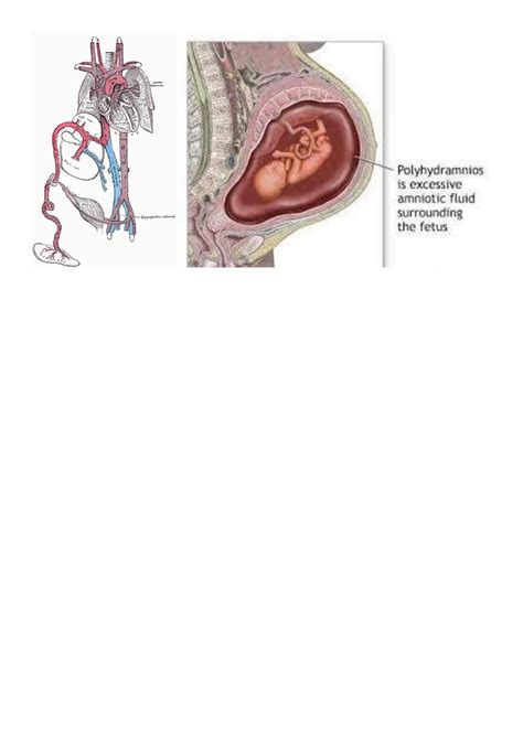 Fetal Circulation And Amniotic Fluid Pdf د ولدان Muhadharaty