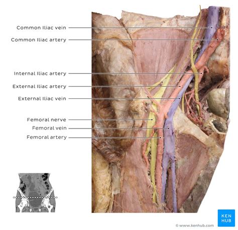 Internal Iliac Artery Anatomy Function Branches Kenhub