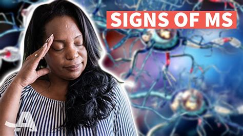 Early Signs Of Multiple Sclerosis Youtube