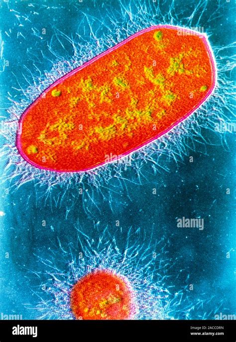 False Colour Transmission Electron Micrograph Tem Of Two Gram