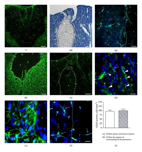 Comparison Of The Expression Of Gfap Days After A Spinal Cord Stab