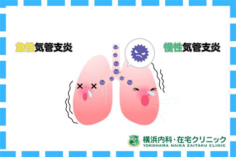 気管支炎におすすめの市販薬9選！ランキング形式で紹介｜横浜内科・在宅クリニック