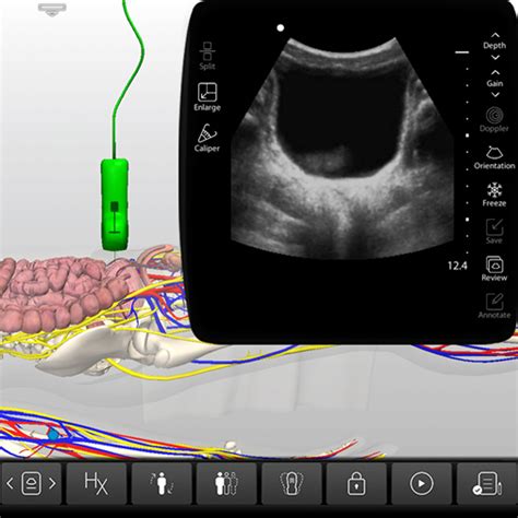 Ultrasound Training - Bladder, Urinary Catheters