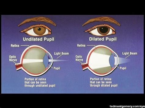 Pupil Dilation