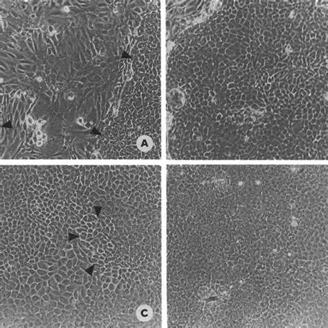 Figure Phase Contrast Micrographs Of Human Osteosarcoma Hos Te 85