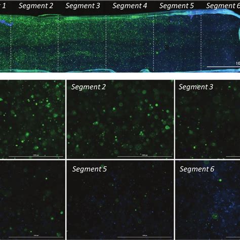 Z Stack Projection Of The Cell Laden Stiffness Gradient Gelma Hydrogel Download Scientific