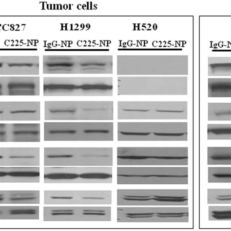 C225 Np Regulates Egfr Signaling Pathway In Tumor Cells But Not In