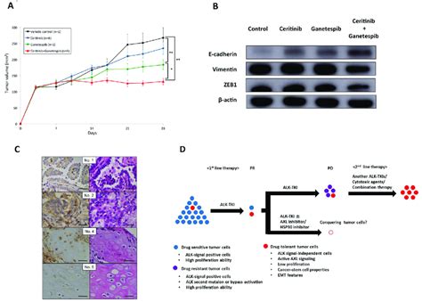 Significance Of Emt Changes In An In Vivo Xenograft Mouse Model And In